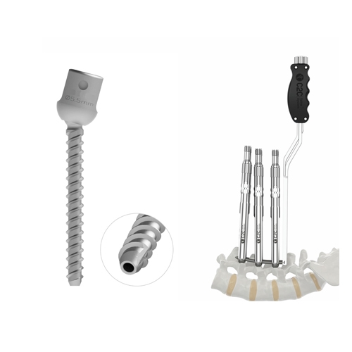 MIS -  Multiaxial Screw Cannulated